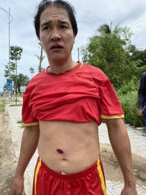 chinh quyen no sung bat 7 nguoi khi cuong che dat dai o xa duong to huyen phu quoc