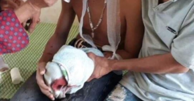 Laptop phát nổ, 3 học sinh lớp 9 bị thương