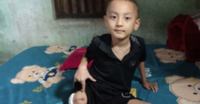 Ung thư cướp đi một phần cơ thể của cậu bé 6 tuổi, gia đình kiệt quệ mong phép màu